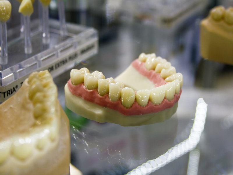 Single dental implant — front tooth replaced with seamless implant and crown