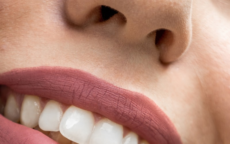 Cosmetic Dentistry